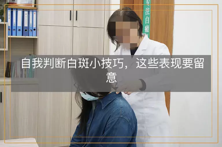 自我判断白斑小技巧，这些表现要留意