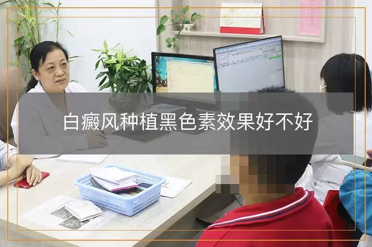 白癜风种植黑色素效果好不好