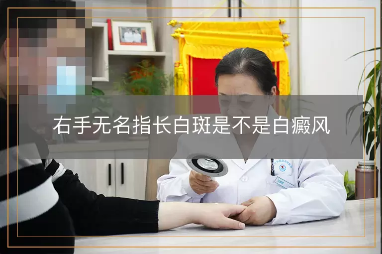右手无名指长白斑是不是白癜风