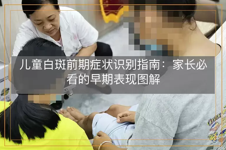 儿童白斑前期症状识别指南：家长必看的早期表现图解