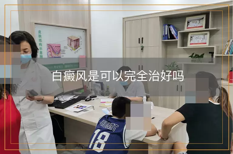 白癜风是可以完全治好吗
