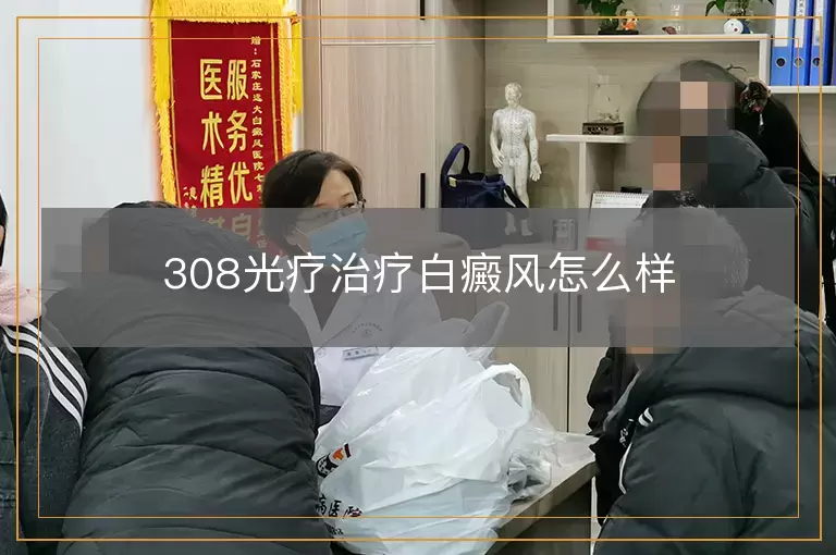 308光疗治疗白癜风怎么样