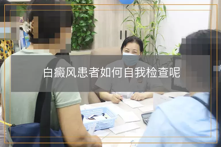 白癜风患者如何自我检查呢