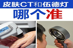 伍德灯检查白斑怀疑是白癜风怎么治