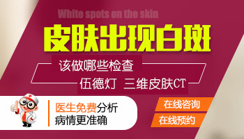 脸上白一块会不会是白癜风