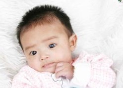 9个月的宝宝患有白癜风怎么治