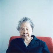 中老年人额头上有小白点是不是白癜风