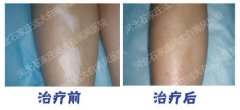 308和311有什么区别