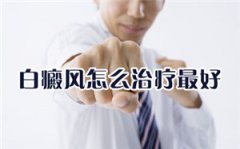 白癜风都那些治疗方法比较好