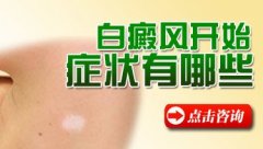 怎么样才能治好毛囊型白癜风