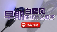 腰部白癜风怎么治疗效果好