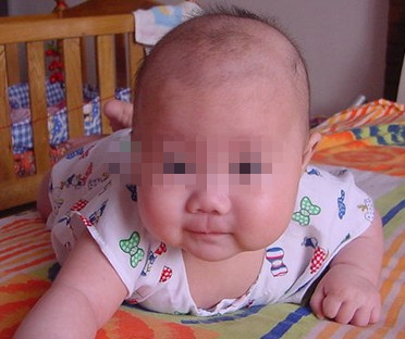 刚出生的婴儿为什么会长白斑