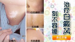 面部白癜风初期症状有哪些呢