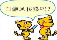 308准分子激光真的可以治疗白癜风病吗
