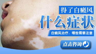 泛发型白癜风有哪些特征