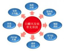 怎么治能治得好肢端型白癜风