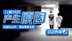 药物治疗白癜风要注意哪些