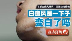 头部白癜风治疗