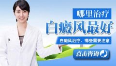 怎样才能彻底的治疗脸部的白癜风