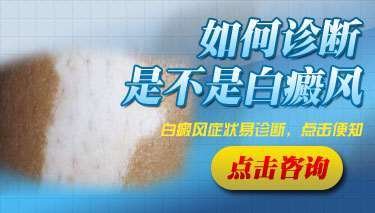 白癜风医院怎么检查白癜风的