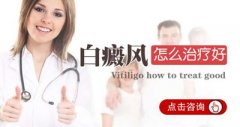 伍德灯检查出白癜风早期要怎么治