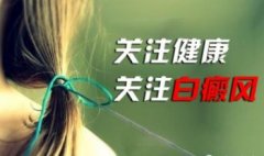 现代医学治疗白癜风常用哪些方法