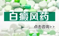 女孩脸上起白癜风有什么治疗方法