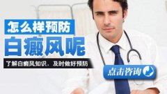 儿童手上的白癜风几天做一次激光好