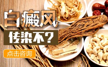 稳定期白癜风怎么治疗好