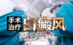 儿童白癜风怎么治疗效果好