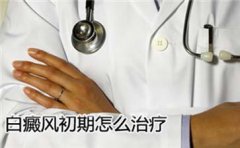 胸部白癜风好久没扩散怎么治疗比较好