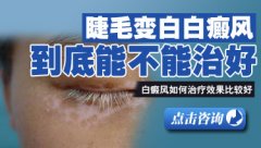 儿童头部白癜风毛发变白怎么治