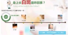 白癜风发展期做308激光能防扩散吗