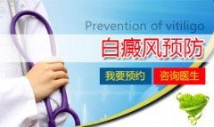 中医中药治疗白癜风时间很长吗