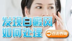治疗白癜风平时要注意什么