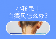 4岁儿童白癜风要怎么治