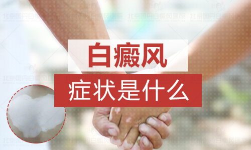 泛发型白癜风白斑早期什么样好治吗