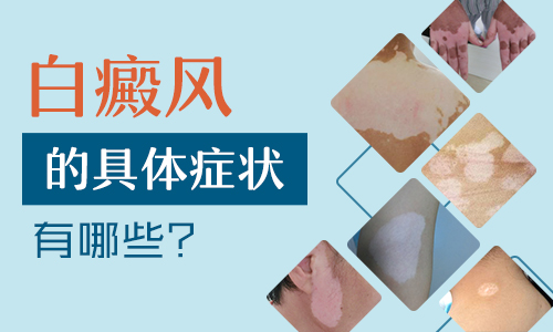 白斑一搓变红是白癜风吗
