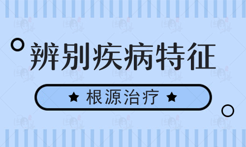 稳定期白癜风的典型表现症状