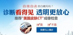 怎么判断白斑是不是白癜风