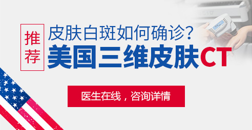 什么仪器检查白斑是否是白癜风比较准