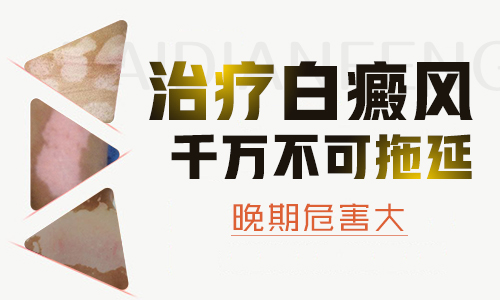 手上白癜风不发展是不是没必要再治了