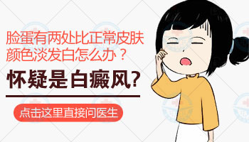 小孩子脸上有淡白斑图片是什么样