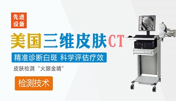 白癜风照皮肤ct表现症状是什么