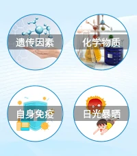 儿童白癜风
