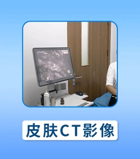 儿童白癜风