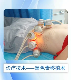 康复理念