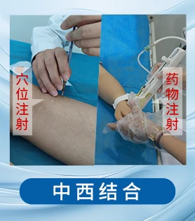 头部白癜风