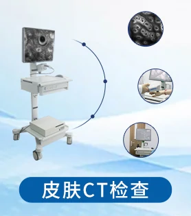 胸部白癜风