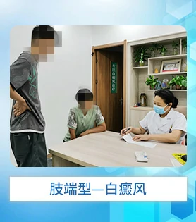 肢端型白癜风白斑病